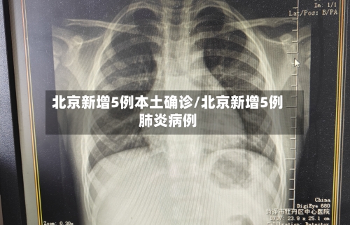 北京新增5例本土确诊/北京新增5例肺炎病例-第1张图片